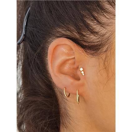 Gold Attachment ROW mit Premium Zirconia