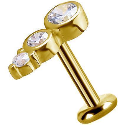 Gold Attachment ROW mit Premium Zirconia